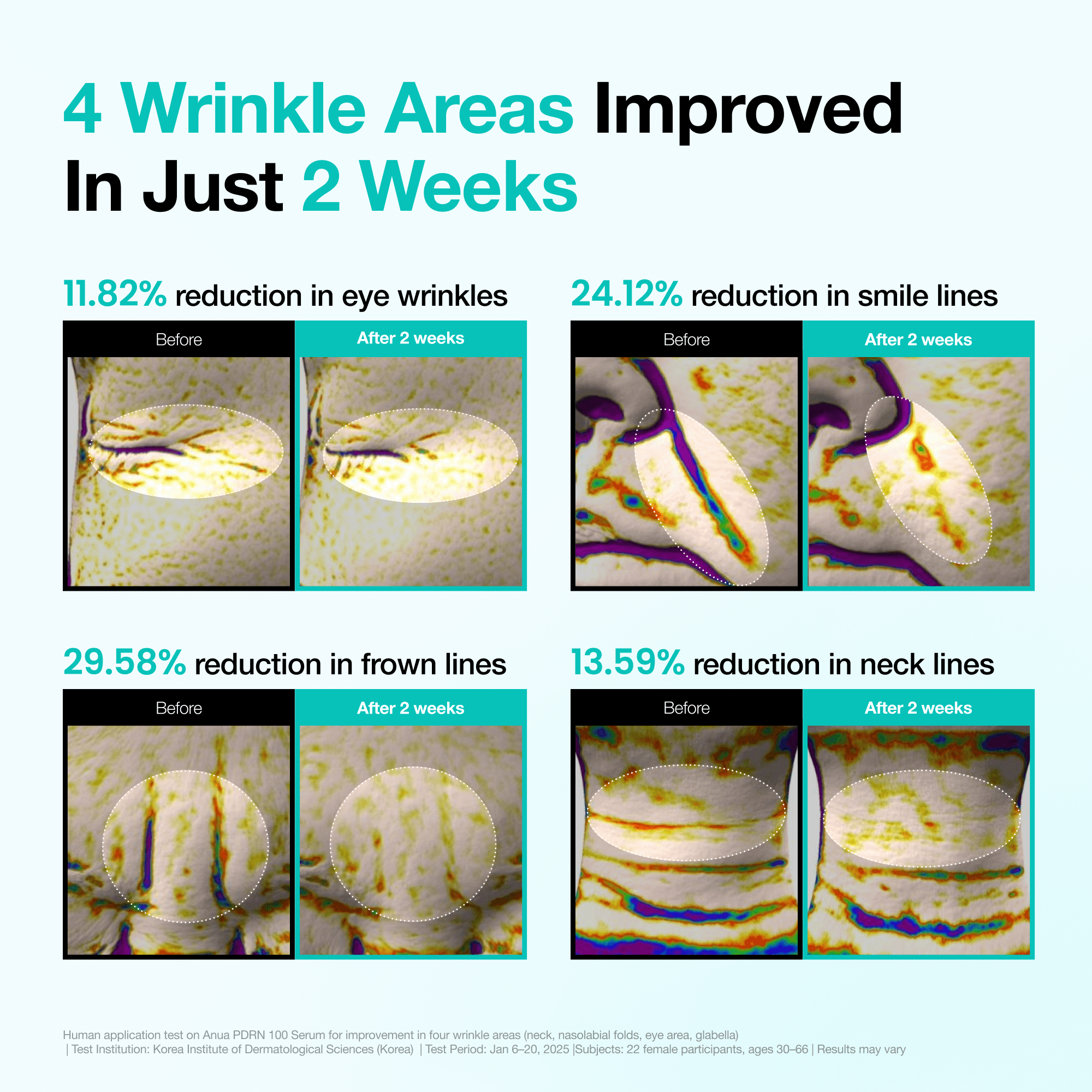 [Secret Deal] 2-Week Wrinkle-Out Routine Set