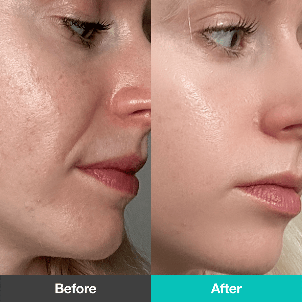 [Secret Deal] 2-Week Wrinkle-Out Routine Set