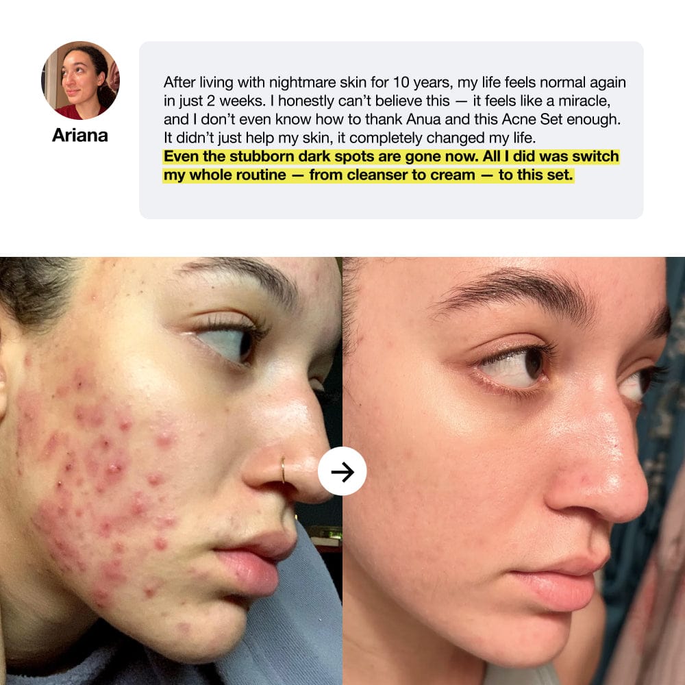 Acne&Dark Spot Care Set